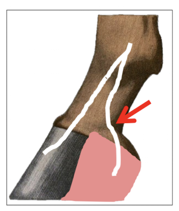 <ul><li><p>Aim to block the <strong>palmar branch</strong> of the palmar digital nerves </p><ul><li><p>= Caudal ½ foot</p></li></ul></li><li><p>Locations:</p><ul><li><p>1cm above coronary band</p></li></ul></li><li><p>2 points of injections (Medial and lateral injection)</p><ul><li><p><strong>Medial palmar branch</strong> of palmar digital nerve</p></li><li><p><strong>Lateral palmar branch</strong> of palmar digital nerve</p></li></ul></li></ul><ul><li><p>Check for function of distal phalanx, navicular bone and distal sesamoid</p></li></ul><p></p>