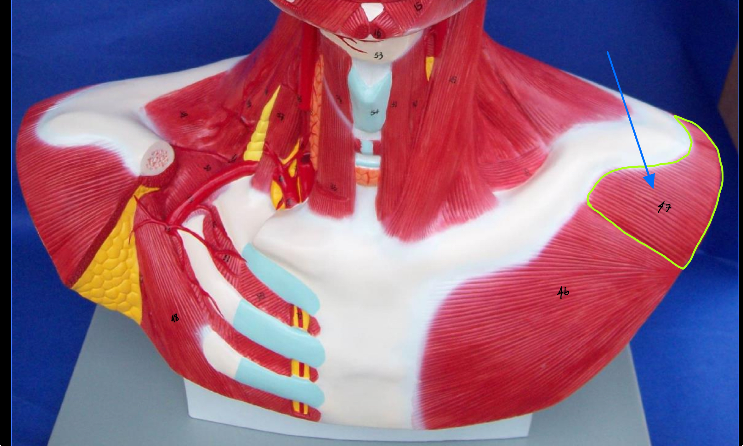 <p>What type of muscle is this ( altay model)</p>