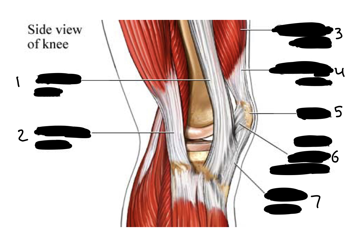 <ol><li><p>iliotibial band</p></li><li><p>hamstring tendon</p></li><li><p>quadriceps muscle</p></li><li><p>quadriceps tendon</p></li><li><p>patella</p></li><li><p>lateral patellar retinaculum</p></li><li><p>patellar tendon</p></li></ol>