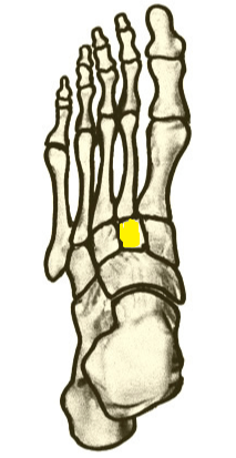 Name the highlighted foot bone