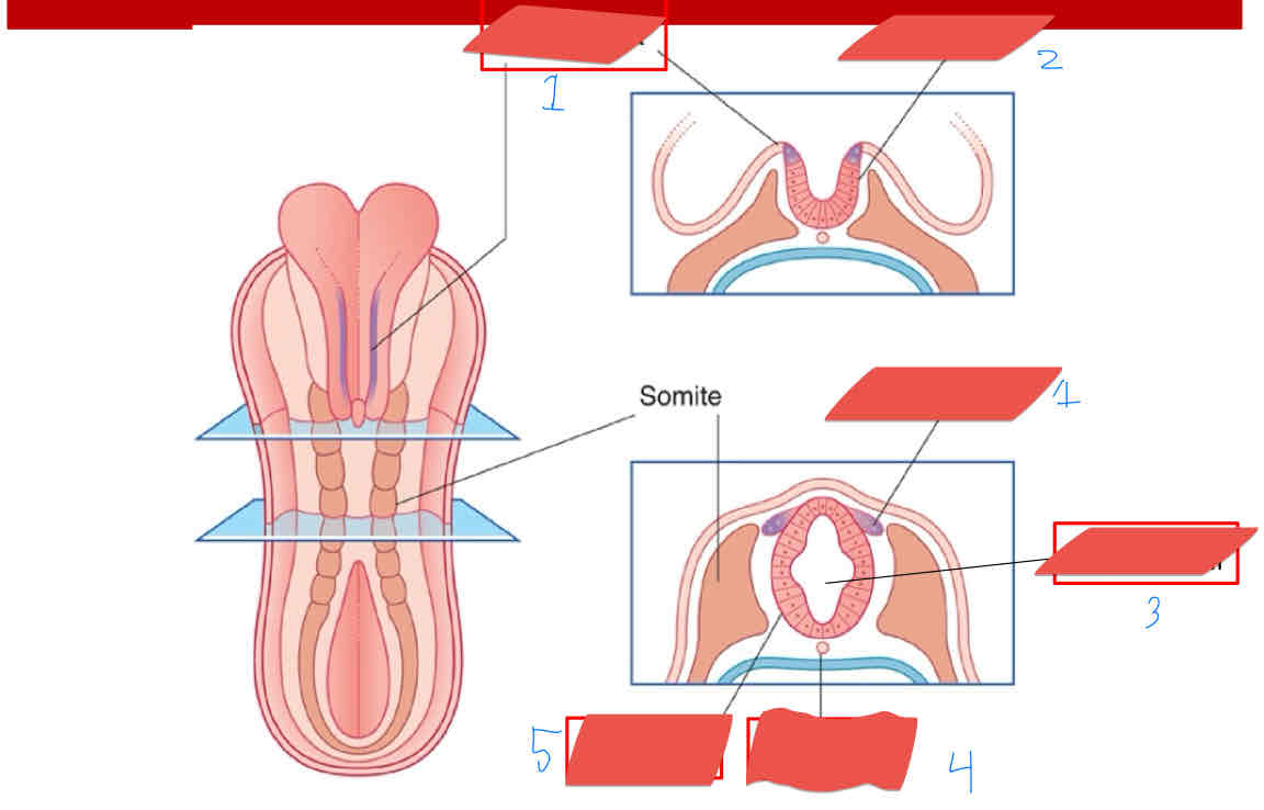 <p>What structure is being shown in number 5?</p>