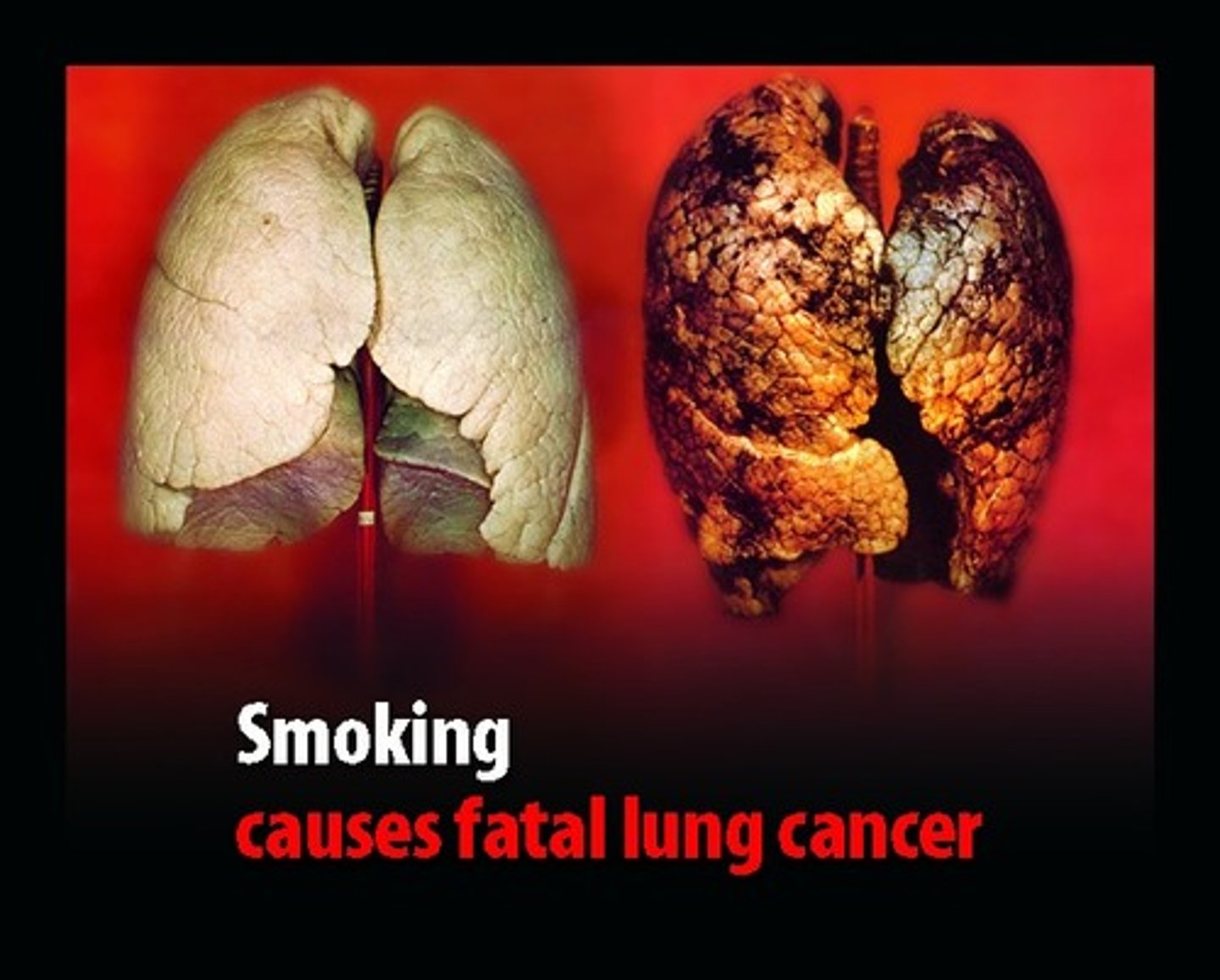 <p>carcinogens in smoke can cause this - tar and nicotine result in tumours</p>