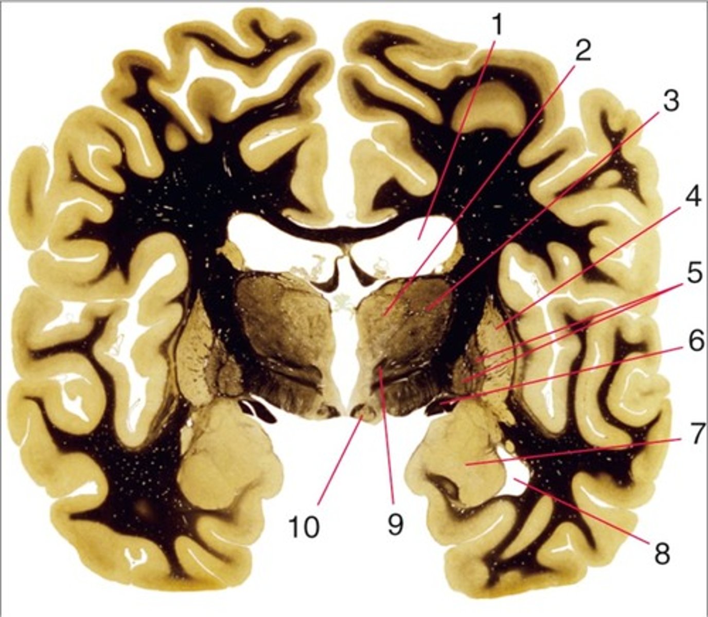 <p>4 and 5</p>