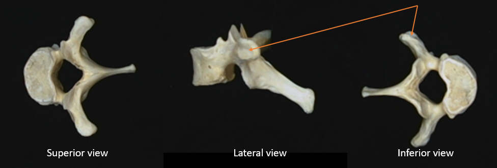 costal facet 