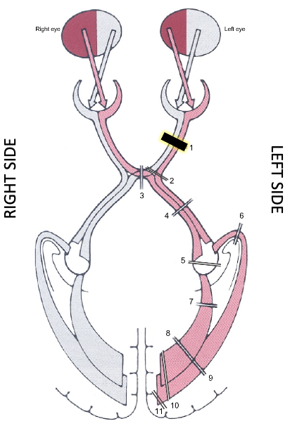 <p>what is it? what does it result in?</p>