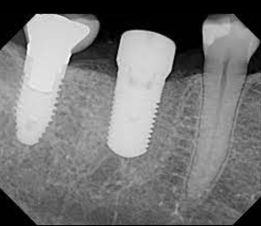 term image