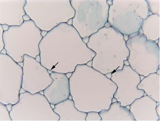 Ragweed parenchyma