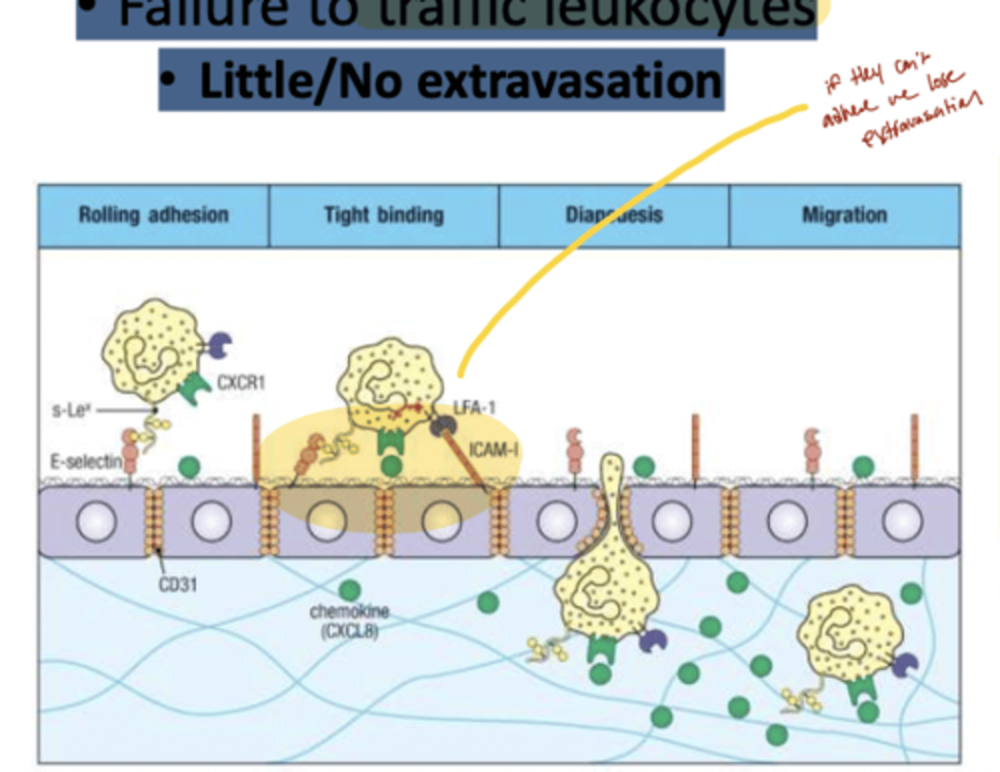 <p>A: LAD is caused by a failure of leukocytes to traffic properly, due to defects in adhesion molecules needed for migration.</p>