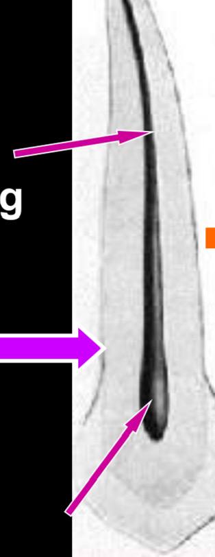 <ul><li><p>narrow pulp chamber</p></li><li><p>root canal is long and tapers into the apical foramen</p></li></ul><p></p>