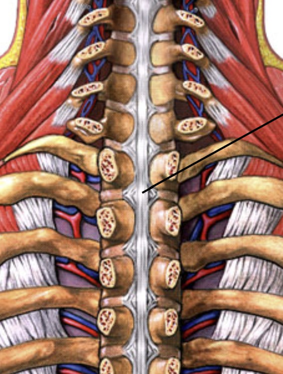 <p>Which ligament of the intervertebral runs along the posterior side of the spine?</p>