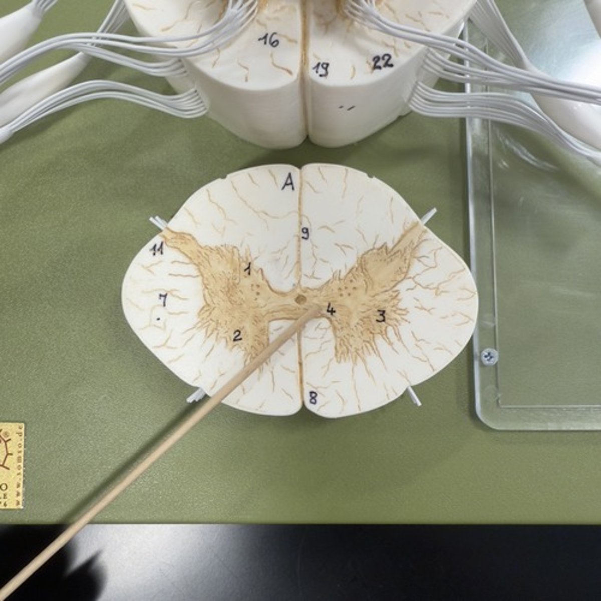 <p>Identify the structure.</p>