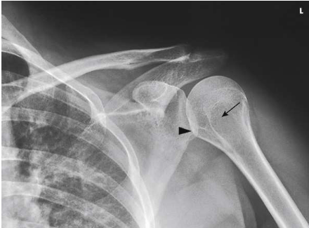 <p>What type of projection, position and anatomy is this?</p>