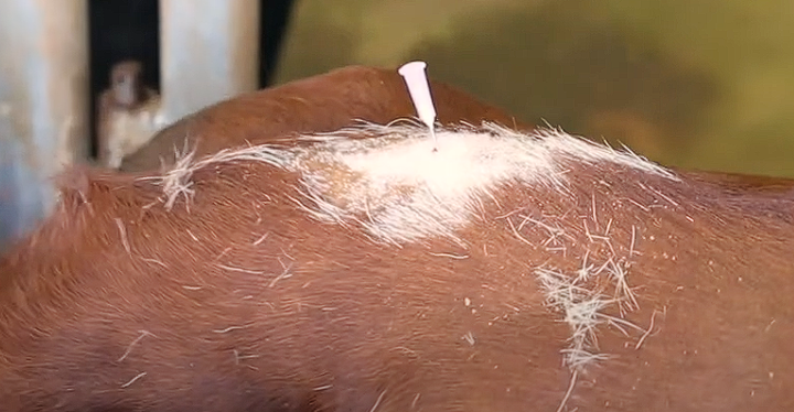 <p>Epidural Nerve Block</p><p>We have the needle in the right location, what next?</p>