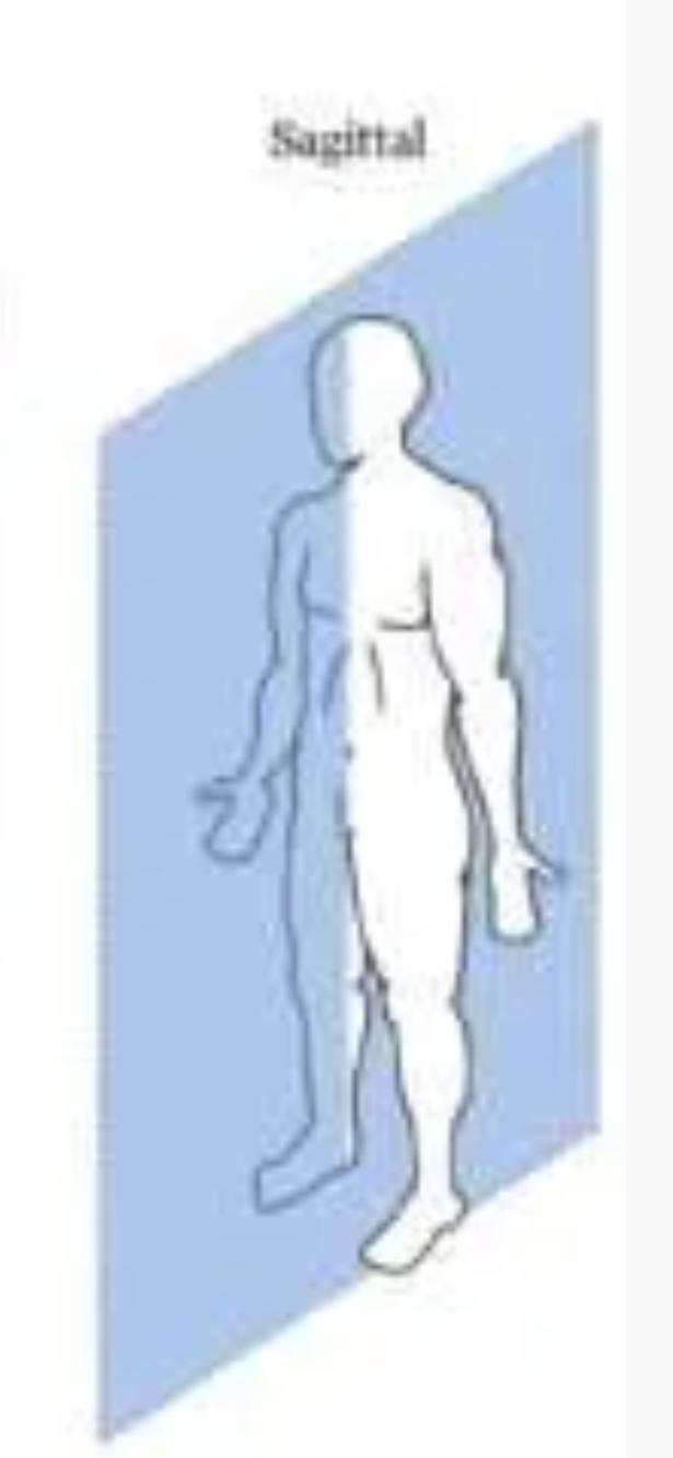 <p>Sagittal </p>