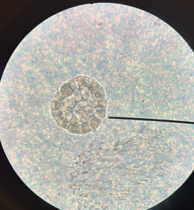 <p>hollow ball of cells trying to form a tube </p>