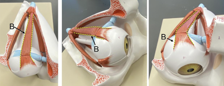 <p>Identify the structure labeled B. </p>