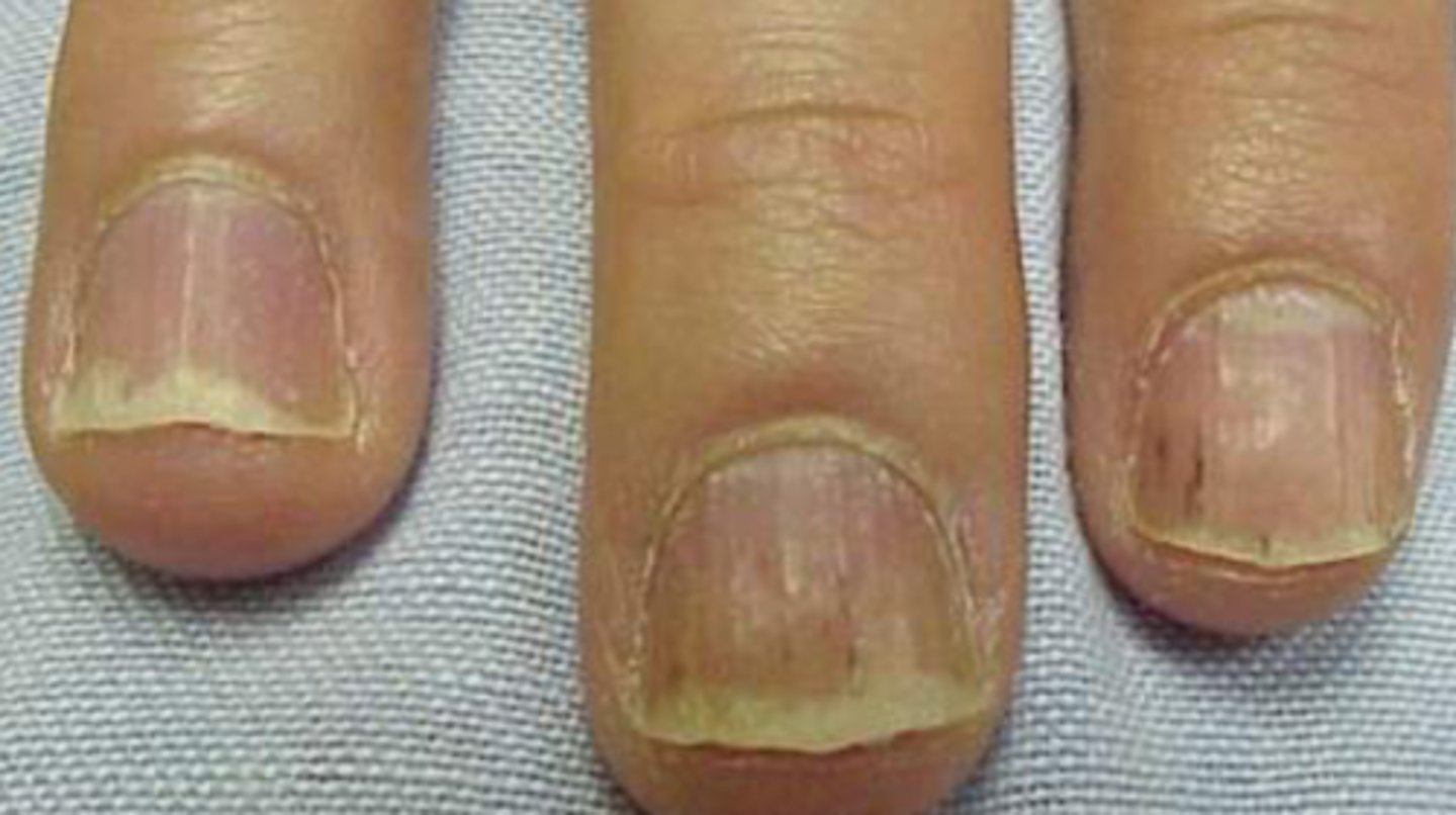 <p>What is the diagnosis?</p>