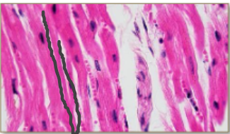 <p>Cardiac Muscle</p>