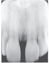 <p>What is the problem with this Elongation X-ray?</p>