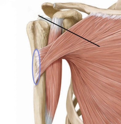 <p>greater tubercle of humerus</p>