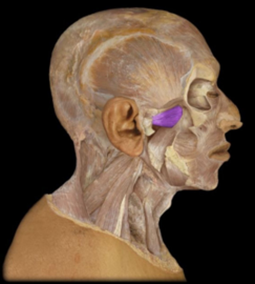 <p>What is the name of this muscle, highlighted in purple and indicated by the arrow?</p>