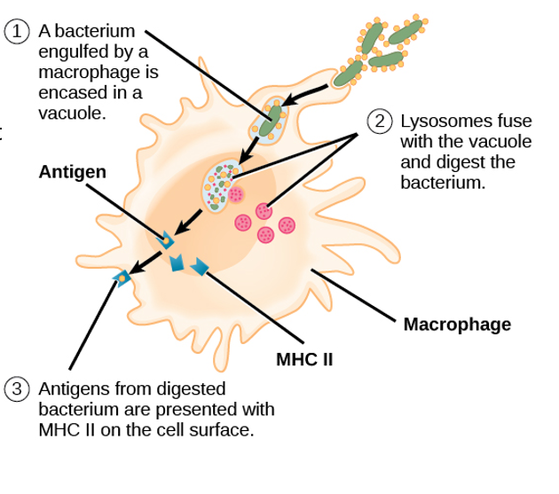 <p><span>•Normally, <strong>macrophages</strong> engulf and destroy the bacteria.</span></p><p><span>•However in some cases, <em>Mycobacterium tuberculosis </em>can survive inside macrophages.</span></p><p><span>•They resist mechanisms which occur after being engulfed (due to their thick waxy cell walls making it difficult to break them down).</span></p><p><span>•They can therefore remain <strong>alive but inactive </strong>inside the tubercles for years.</span></p><p><span>•The infected person presents no symptoms of infection.</span></p><p><span>•T killer cells destroy any infected macrophages outside of the tubercles, preventing the spread beyond the tubercle.</span></p><p><span>•But the live and inactive bacteria remain can within the them.</span></p><p><span>•The antigens remain hidden to the rest of the white blood cells in the body.</span></p><p><span>•If the immune system is weakened, the bacteria may no longer be contained inside the tubercles.</span></p>
