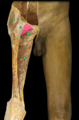Resists excessive abduction of hip