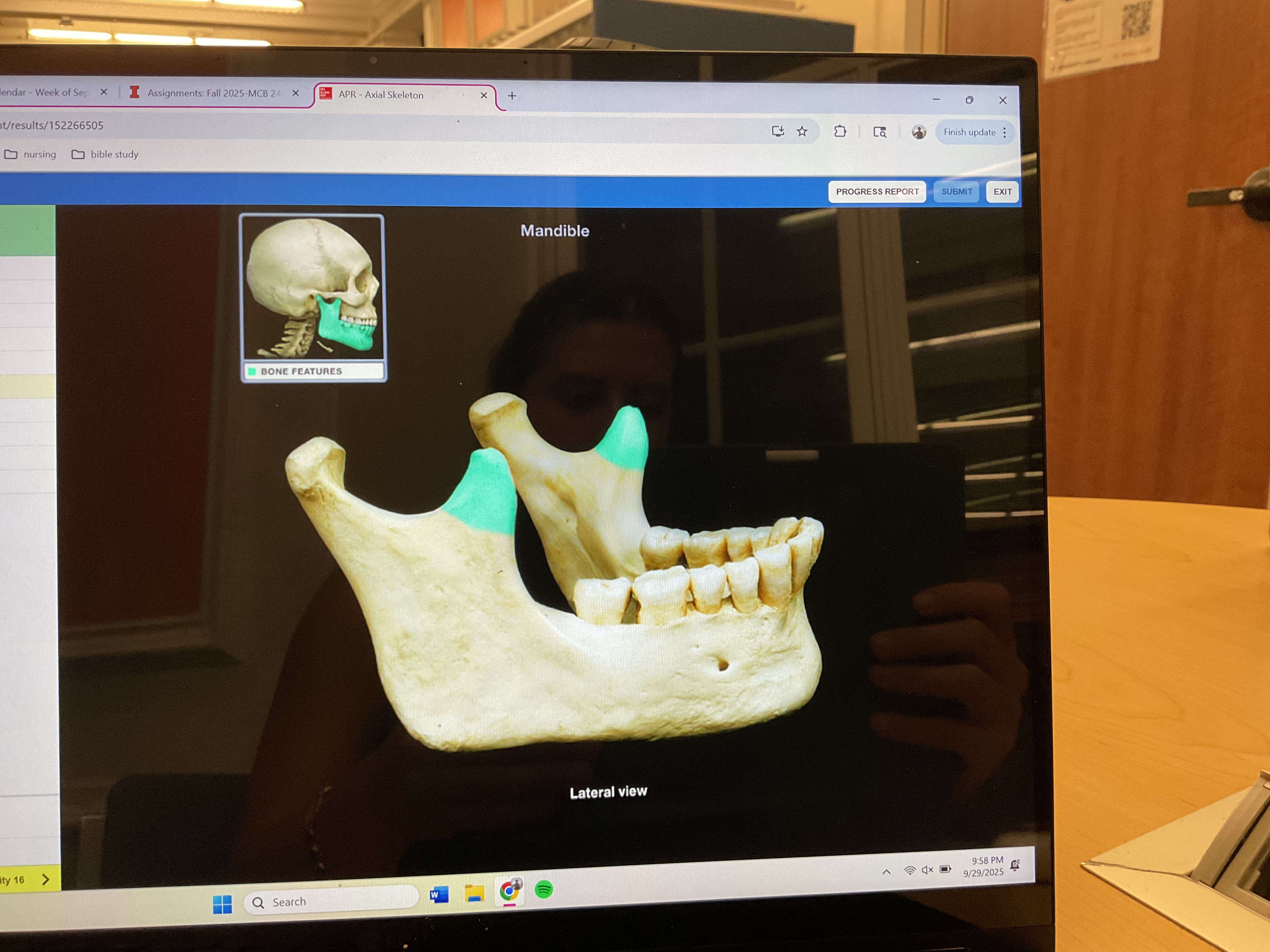 <p>Condyle process of mandible </p>