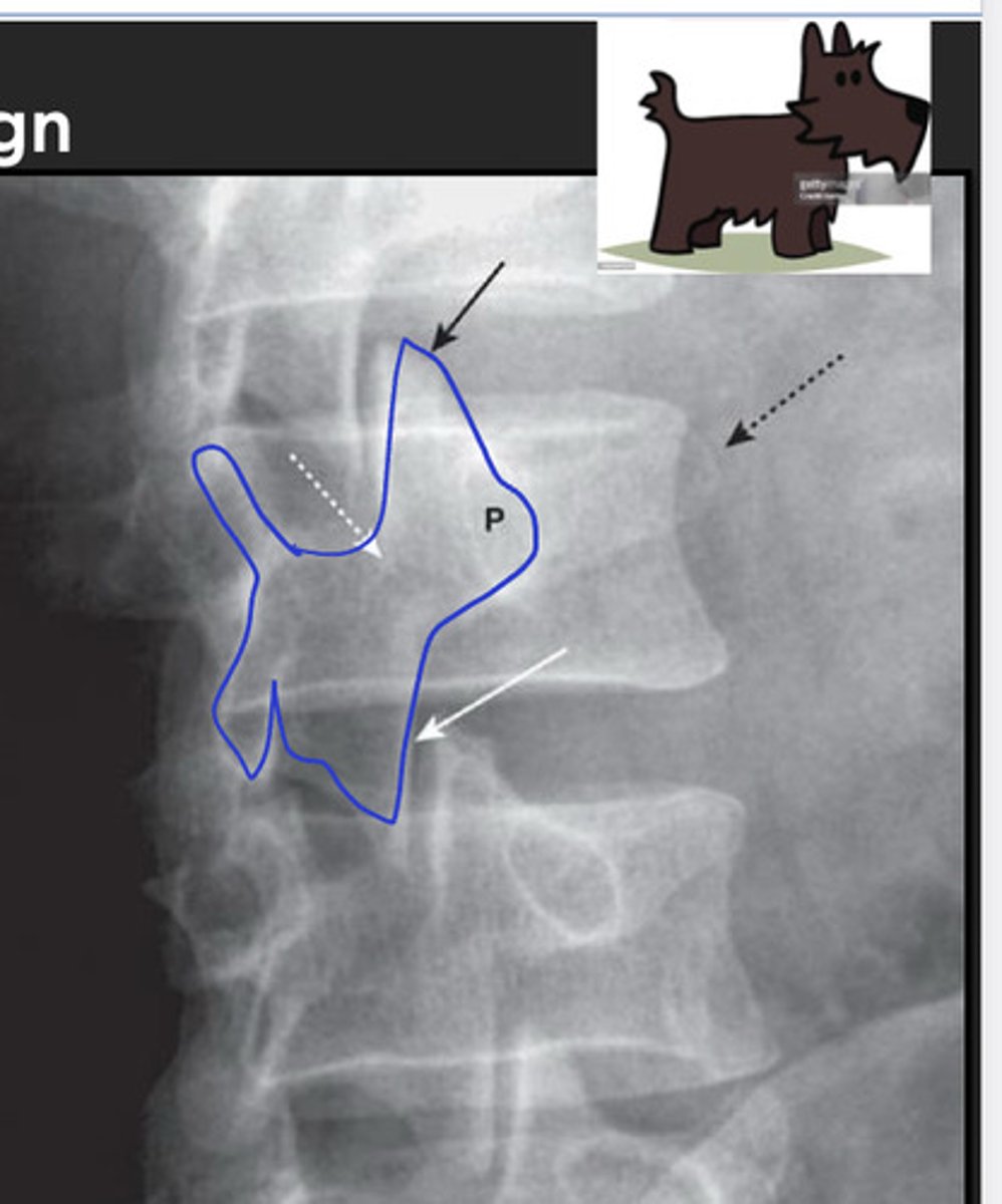 <p>seen on oblique views; "the best dog in medicine"</p>