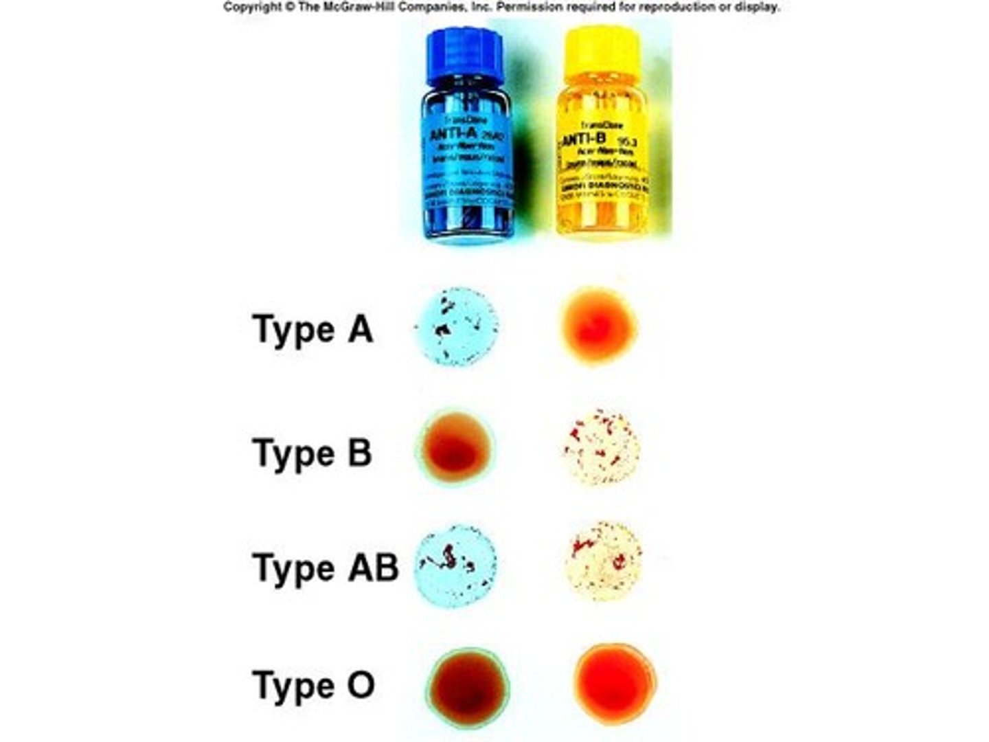 <p>Determining blood group based on antigens.</p>