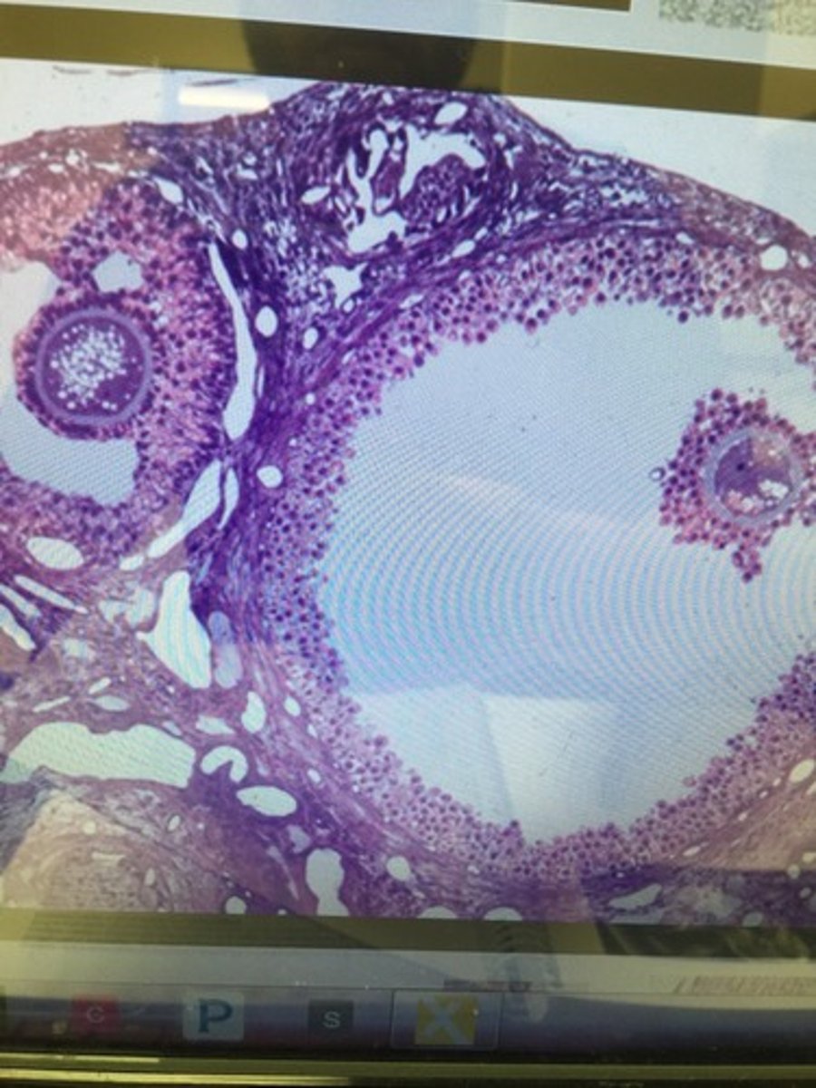 <p>Every 28 days, a secondary follicle develops into one of these, which surrounds a secondary oocyte..?</p>