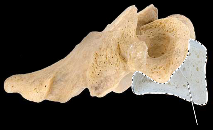 <p>What part of the vertebra is highlighted?</p><p>What type of vertebra is this (which region is this vertebra from)?</p><p>(Lateral view, right side).</p>
