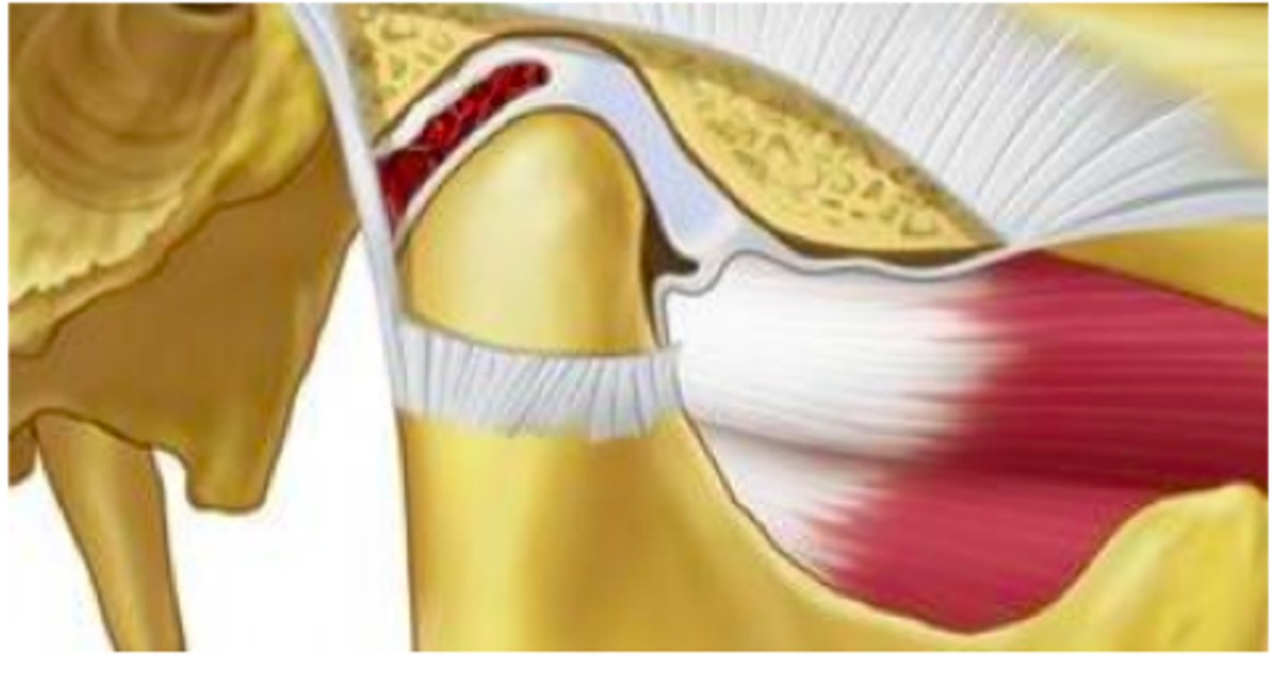 <p>anteriort: Ledkapsel och m. pterygoideus lateralis</p><p>posteriort: Retrodiskal vävnad</p><p>Lateralt och medialt: kollateralligament</p>