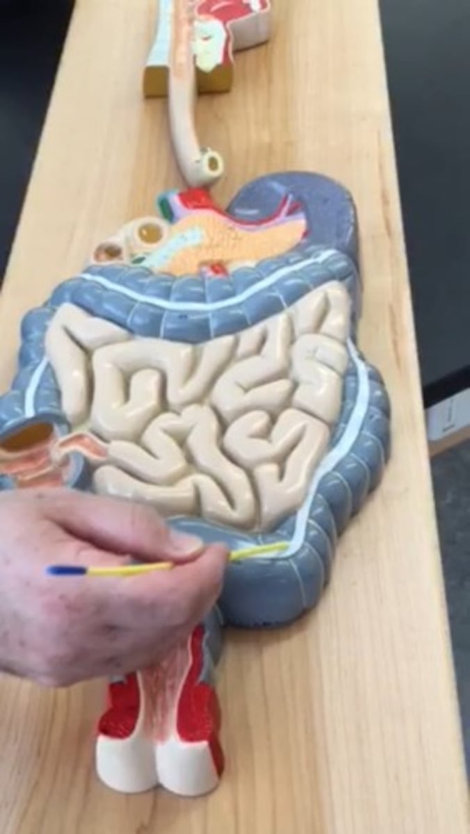 <p>What part of the large intestine is this?</p>