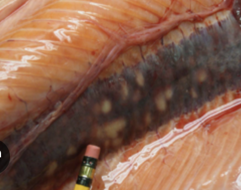 <p><strong>Causative agent:</strong></p><ul><li><p><em><mark data-color="red" style="background-color: red; color: inherit;">Renibacterium salmoninarum</mark></em><mark data-color="red" style="background-color: red; color: inherit;"> </mark>(Gram-positive, intracellular)</p></li></ul><p><strong>Hosts:</strong></p><ul><li><p>Cultured salmonids of <strong>all ages</strong></p></li><li><p>Freshwater and seawater stages</p></li><li><p>Atlantic salmon, rainbow trout, wild salmonids</p></li></ul><p></p><p><strong>Transmission</strong></p><ul><li><p><strong>Horizontal:</strong></p><ul><li><p>Waterborne exposure</p></li><li><p>Entry via <strong>GIT and skin lesions</strong></p></li></ul></li><li><p><strong>Vertical:</strong></p><ul><li><p><strong>Transovarian transmission via eggs</strong> (very important)</p></li></ul></li><li><p><strong>Vectors:</strong></p><ul><li><p>Not proven; mechanical vectors possible but not essential</p></li></ul></li></ul><p></p><p><strong>Clinical signs</strong></p><ul><li><p>Often <strong>non-specific or absent</strong></p></li><li><p>Lethargy, anorexia, poor growth (when present)</p></li></ul><p></p><p><strong>Pathological changes</strong></p><ul><li><p><strong>Kidney most affected</strong>:</p><ul><li><p>Granulomatous and necrotic lesions</p></li><li><p>White caseous deposits</p></li></ul></li><li><p>Spread to <strong>liver, spleen, heart</strong></p></li><li><p>Bacteria enter bloodstream → <strong>bacteremia</strong></p></li><li><p>Leads to <strong>anemia and immunosuppression</strong></p></li><li><p>Frequent <strong>secondary infections</strong></p></li></ul><p></p><p><strong>Prevention & Therapy</strong></p><ul><li><p><strong>Antibiotics</strong> (limited effect, long treatment needed)</p></li><li><p><strong>Vaccines:</strong> Renogen</p></li><li><p>Key prevention:</p><ul><li><p><strong>Egg screening and disinfection</strong></p></li><li><p>Broodstock control and culling</p></li><li><p>Biosecurity</p></li></ul></li></ul><p></p><p><strong>Diagnosis</strong></p><ul><li><p><strong>Necropsy:</strong> enlarged kidney with white nodules</p></li><li><p><strong>Bacterial culture</strong></p></li></ul><p></p><p><strong>One-sentence oral exam answer</strong></p><figure data-type="blockquoteFigure"><div><blockquote><p>“BKD is a chronic intracellular bacterial disease of salmonids caused by <em>Renibacterium salmoninarum</em>, transmitted horizontally and vertically via eggs, characterized by granulomatous kidney lesions, bacteremia, anemia, and immunosuppression.”</p></blockquote><figcaption></figcaption></div></figure><p></p>