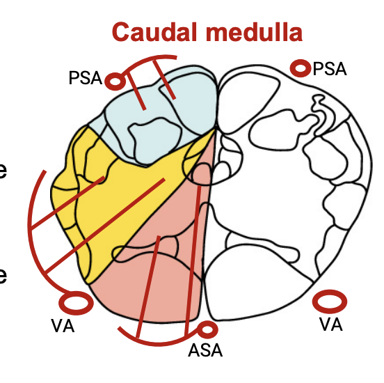 <p>Anterior Spinal Artery</p><p><strong>Posterior Spinal Artery</strong></p><p>Vertebral Artery</p>