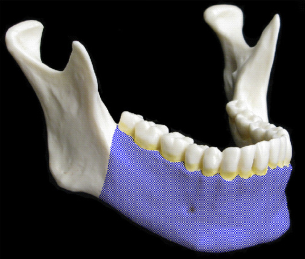 <p>horizontal portion of the lower jaw</p>