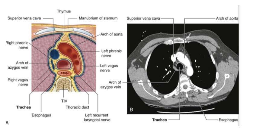 <ul><li><p>Trachea —</p><ul><li><p>Midline structure palpable in the jugular notch as it enters the superior mediastinum </p></li><li><p>Divides into right &amp; left main bronchi just inferior to the transverse plane between sternal angle &amp; vertebral level TIV/V — also where the esophagus continues into the posterior mediastinum</p></li></ul></li><li><p>Esophagus —</p><ul><li><p>Posterior to the trachea &amp; immediately anterior to the vertebral column</p></li></ul></li></ul>