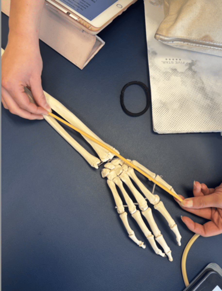 <p>What is this muscle?</p>