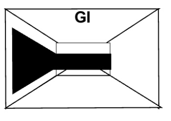 <p>What restoration is shown on the chart?</p>