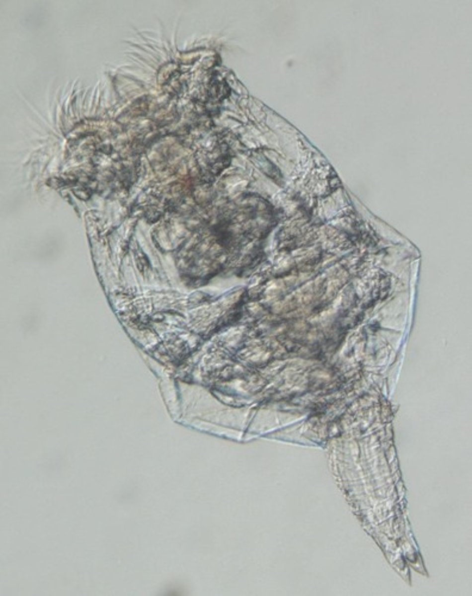<p>It is a ciliated organ at the anterior end used for feeding.</p>