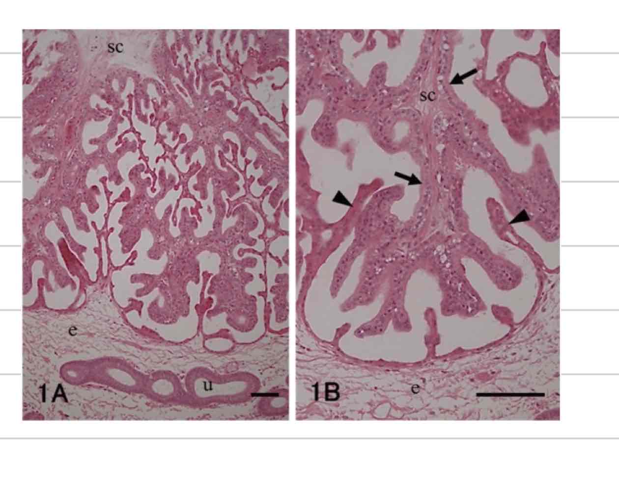 <ul><li><p>not a smooth interface</p></li><li><p>Villi on both surfaces</p></li><li><p>Chorionic villi- extend from chorioallantois</p></li><li><p>Endometrial villi- extend from maternal endometrium</p></li></ul>