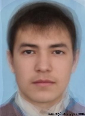 <p>Identify this Phenotype</p>