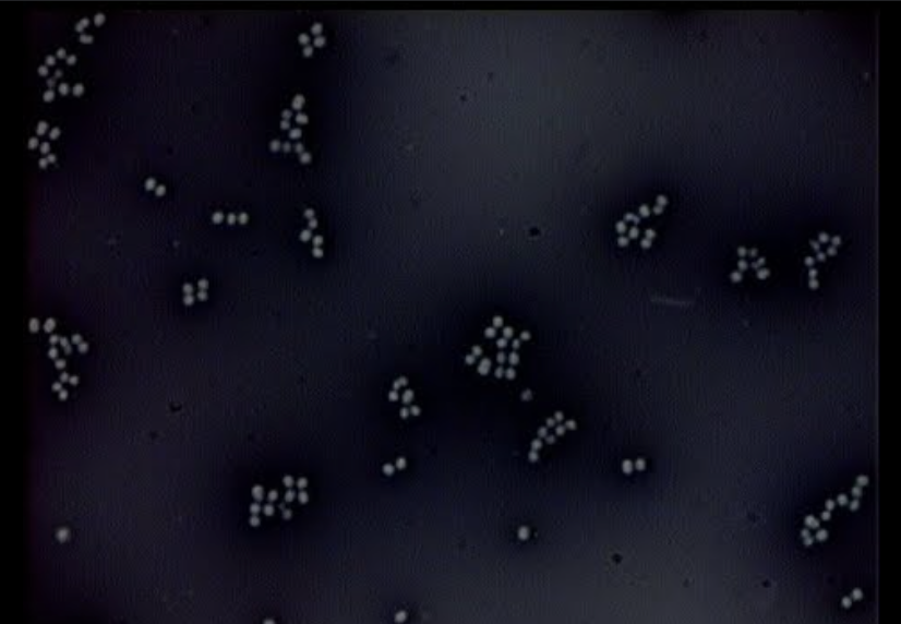 <p>How do you know if you are looking at a negative stain?</p>