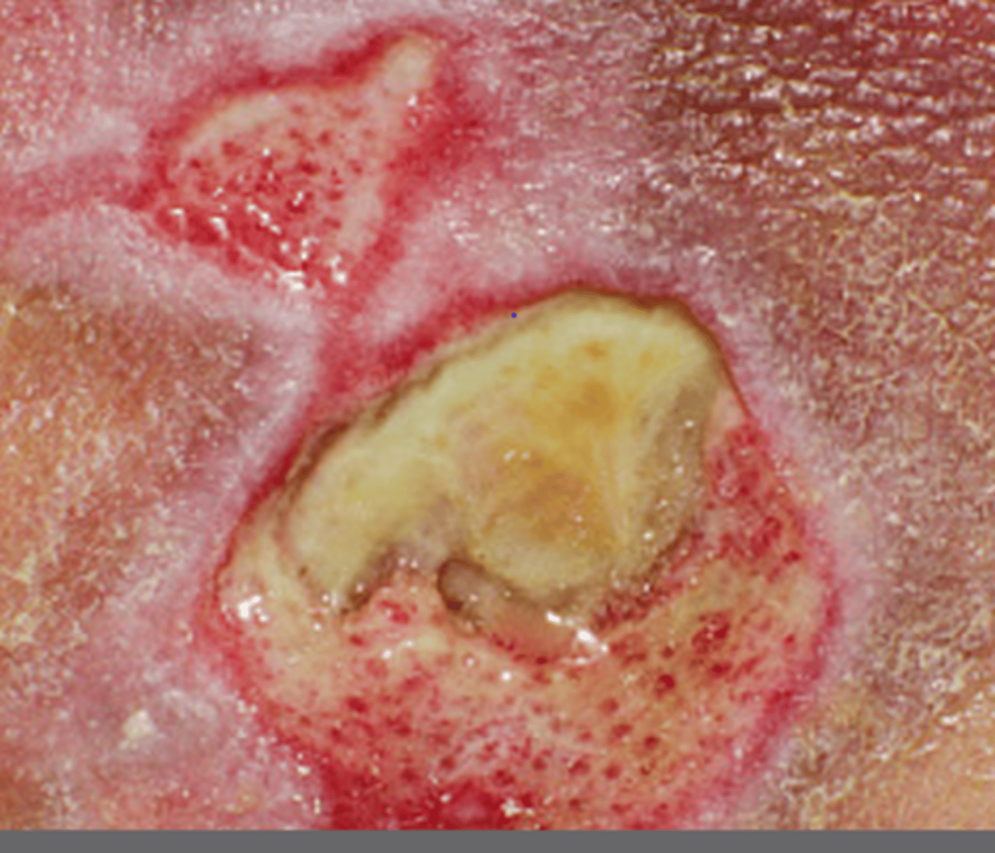 <p>new overseas sti</p>