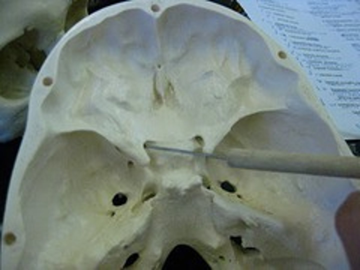 <p></p>