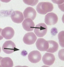 <p>What are the arrows pointing to?</p>
