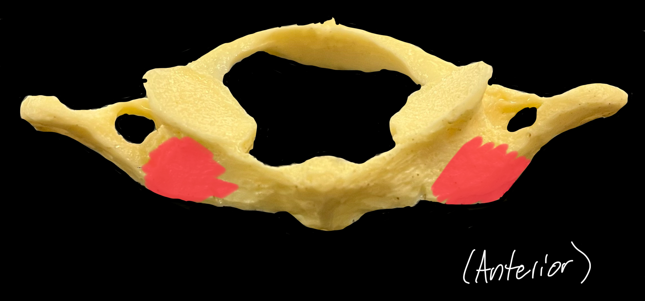 What is highlighted in red?

What passive structure attaches here?