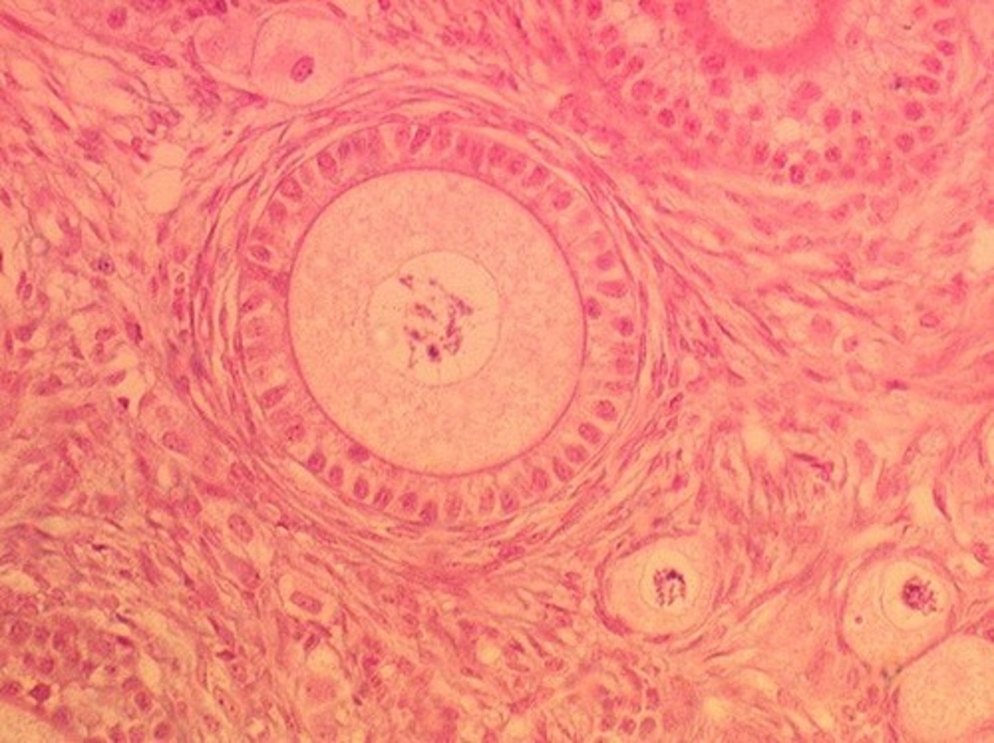 <p>Layer of cells surrounding the ovarian follicle.</p>