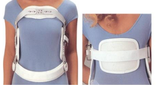 <p>what is the name, type, and purpose of this thoracic orthotic?</p>